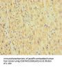 HEPACAM2 Antibody