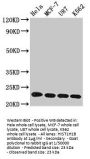 HIST1H1B (Ab-16) Antibody