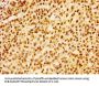 HIST1H1B (Ab-16) Antibody