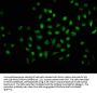 2-hydroxyisobutyryl-HIST1H1C (K116) Antibody