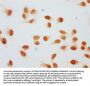 2-hydroxyisobutyryl-HIST1H1C (K128) Antibody
