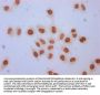 Formyl-HIST1H1C (K96) Antibody