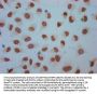 Crotonyl-HIST1H1C (K158) Antibody