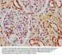 HIST1H1C (Ab-164) Antibody