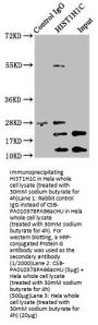 Acetyl-HIST1H1C (K96) Antibody