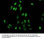 Acetyl-HIST1H1C (K96) Antibody