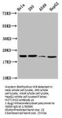 β-hydroxybutyryl-HIST1H1D (K106) Antibody