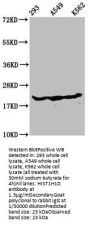 β-hydroxybutyryl-HIST1H1D (K75) Antibody