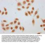 β-hydroxybutyryl-HIST1H1D (K75) Antibody