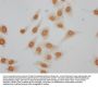 Formyl-HIST1H1E (K62) Antibody