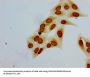 Acetyl-HIST1H1E (K51) Antibody