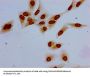 Acetyl-HIST1H1E (K63) Antibody