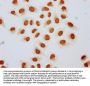 Acetyl-HIST1H2AG (K15) Antibody