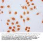 2-hydroxyisobutyryl-HIST1H2AG (K36) Antibody