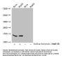 Acetyl-HIST1H2AG (K74) Antibody