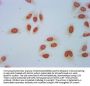 Crotonyl-HIST1H2AG (K118) Antibody