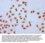 Formyl-HIST1H2AG (K95) Antibody