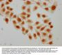 Succinyl-HIST1H2AG (K95) Antibody