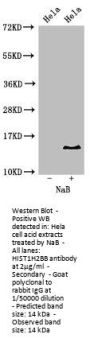 Acetyl-HIST1H2BB (K16) Antibody