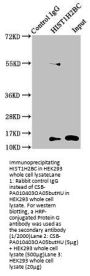 Butyrly-HIST1H2BC (K5) Antibody