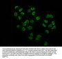 Acetyl-HIST1H2BC (K108) Antibody