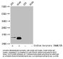 Acetyl-HIST1H2BC (K116) Antibody