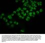 Acetyl-HIST1H2BC (K116) Antibody