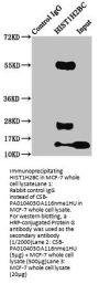 HIST1H2BC (Ab-116) Antibody