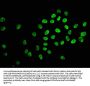 Acetyl-HIST1H2BC (K120) Antibody