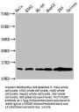 HIST1H2BC (Ab-120) Antibody