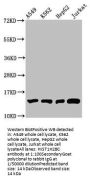 Mono-methyl-HIST1H2BC (K12) Antibody
