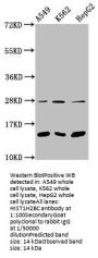 Mono-methyl-HIST1H2BC (K15) Antibody