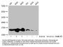 Acetyl-HIST1H2BC (K20) Antibody