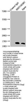 Acetyl-HIST1H2BC (K20) Antibody