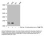 β-hydroxybutyryl-HIST1H2BC (K20) Antibody