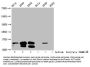 Butyrly-HIST1H2BC (K20) Antibody
