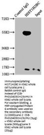 Crotonyl-HIST1H2BC (K23) Antibody
