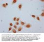 Acetyl-HIST1H2BC (K24) Antibody