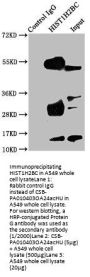 Acetyl-HIST1H2BC (K24) Antibody