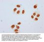 Acetyl-HIST1H2BC (K85) Antibody