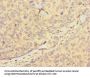HIST1H2BD Antibody