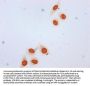 β-hydroxybutyryl-HIST1H3A (K4) Antibody