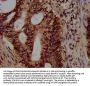 HIST1H3A (Ab-4) Antibody