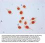β-hydroxybutyryl-HIST1H3A (K9) Antibody