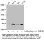 Acetyl-HIST1H3A (K122) Antibody