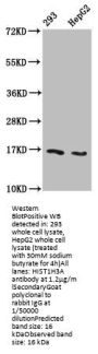 β-hydroxybutyryl-HIST1H3A (K122) Antibody