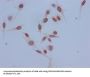Acetyl-HIST1H3A (K14) Antibody