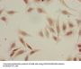Acetyl-HIST1H3A (K18) Antibody