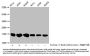 β-hydroxybutyryl-HIST1H3A (K18) Antibody
