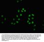 β-hydroxybutyryl-HIST1H3A (K18) Antibody
